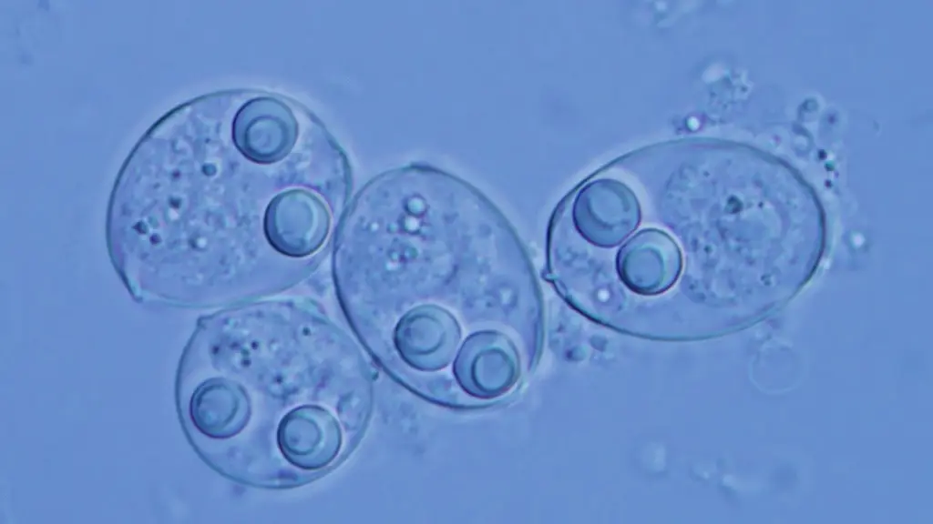 Real Image of Myxozoa
