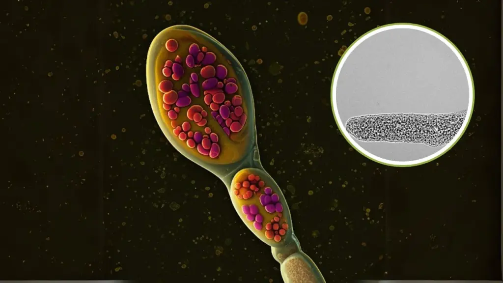 What Are Myxozoans